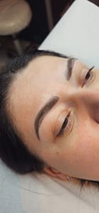 laser picoseconde esthétique ZENITH avant